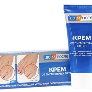 Kem Dành Cho Da Tay Kpem Nga Type 50ml / (Trị Đồi Mồi, Vết Nám, Sạm, Đốm Nâu )