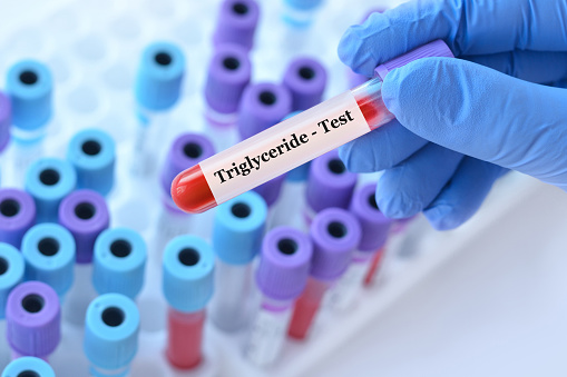 uống gì để giảm triglyceride