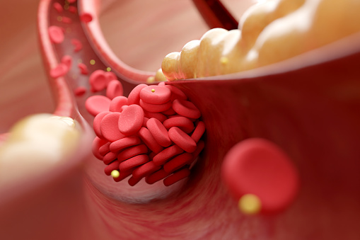 uống gì để giảm triglyceride