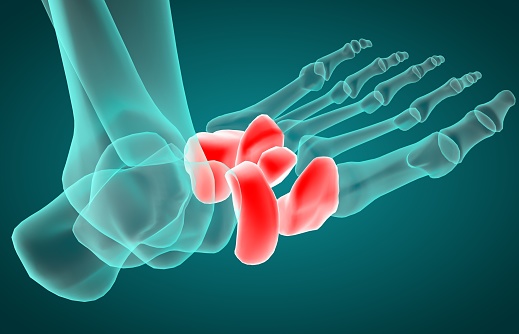 axit uric cao, axit uric cao kiêng ăn gì, acid uric cao nên kiêng ăn gì, ăn gì để giảm axit uric, chế độ ăn cho người bị tăng axit uric